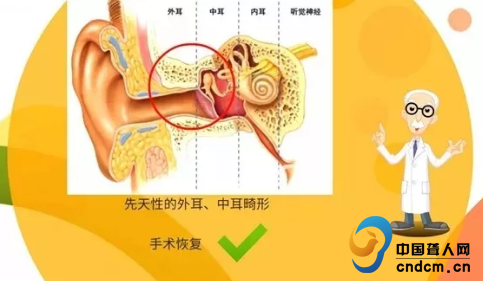 听力与言语康复学专业的沟通障碍克服_听力与言语康复学介绍