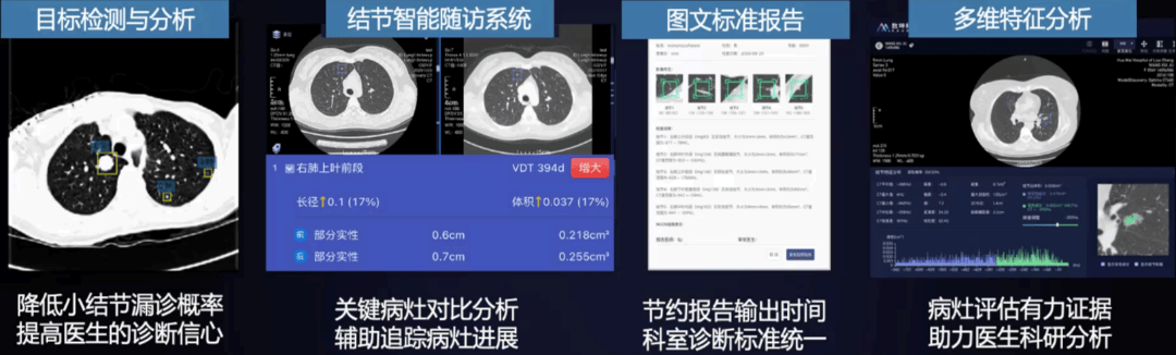 AI在智能影像诊断中的应用课程：医学图像分析_ai在医学影像诊断中的作用